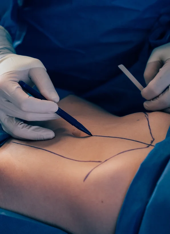 procedure-expect-body